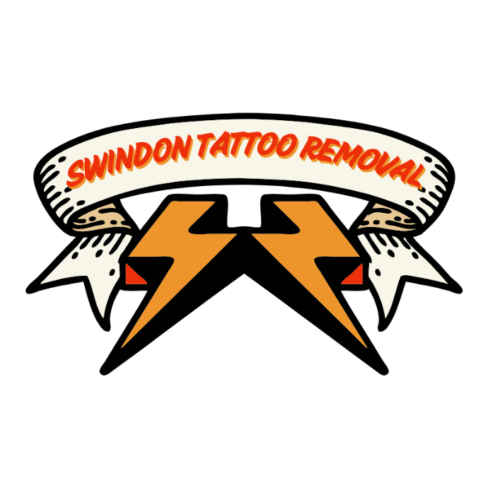 Swindon Tattoo Removal
