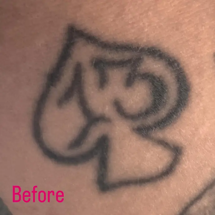 before tattoo